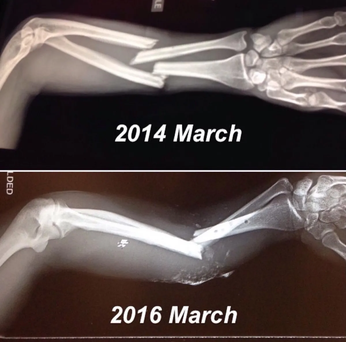 March 2014 and March 2016. The same spot, broken twice